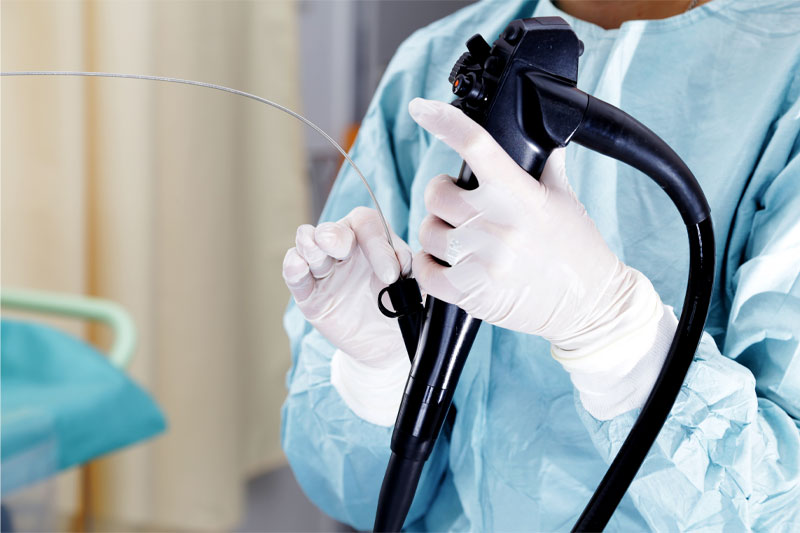 Lekarz przeprowadza zabieg kolonoskopii. Jak się przygotować do zabiegu?